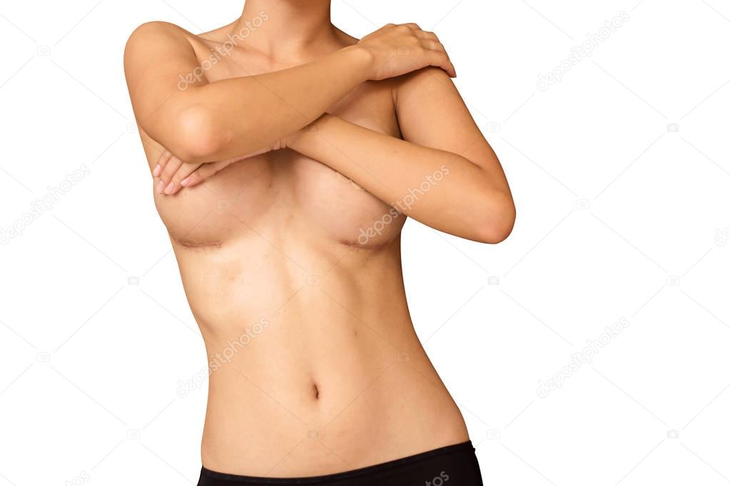 The perfect shape of asian women's breasts after surgery.
