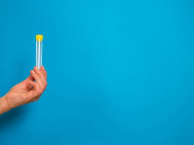 Mavi arkaplandaki analiz tüpüyle kopyalama alanı