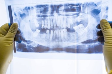 Tam ağız tüm diş gösteren X-ray, panoramik