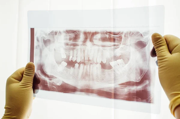 Exploración panorámica del primer plano de la mutación dental —  Fotos de Stock
