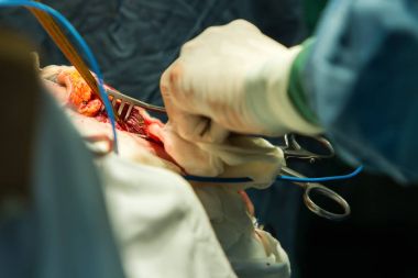 Trepanasyon kafatası işleyişi.