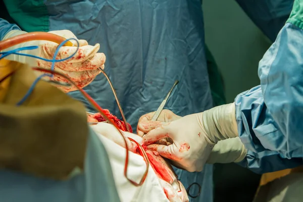 Operazione di trafilatura del cranio . — Foto Stock