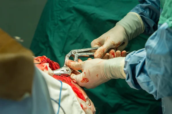 Close Das Mãos Cirurgião Usando Carrapatos Para Quebrar Crânio Durante — Fotografia de Stock