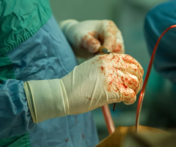 Ameliyat Sırasında Kanlı Eldivenlerle Bir Cerrahın Ellerine Yakın Çekim — Stok fotoğraf