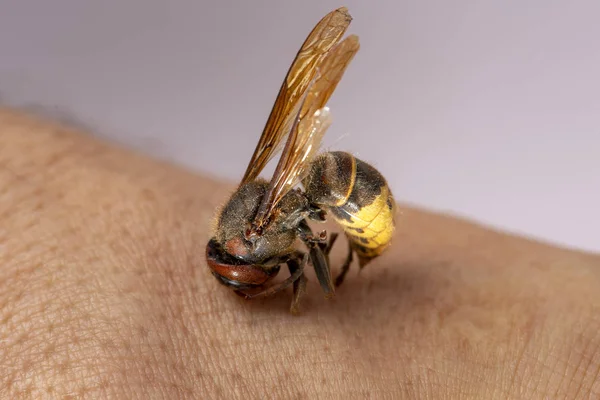 hornet bites a mans hand. hornet bites a mans hand on a white background