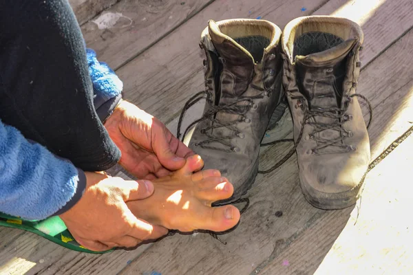 Foot Problems Mountain Hike — Stock Photo, Image