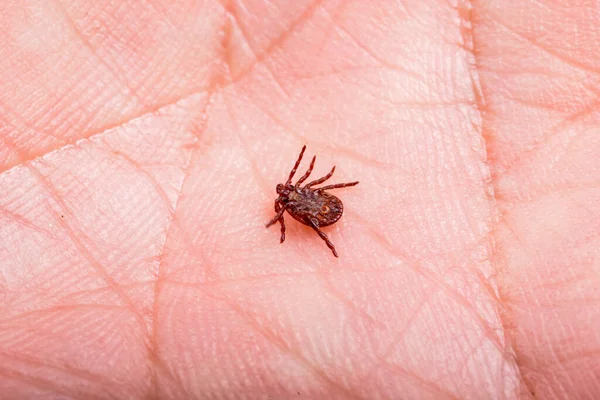 Encefalite Carrapato Nas Mãos Homem Fotografia Macro — Fotografia de Stock