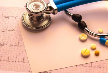 kardiyogram üzerinde metal stetoskop