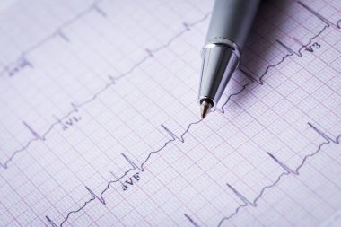 kardiyogram ve teknik kalem