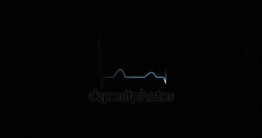 Ritim Ekg, EKG kalp. Nabız kalp atışını.