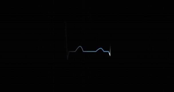 Ritmo cardíaco ECG, ECG. Pulso cardíaco . — Vídeo de Stock