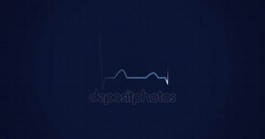 Ritim Ekg, EKG kalp. Nabız kalp atışını.
