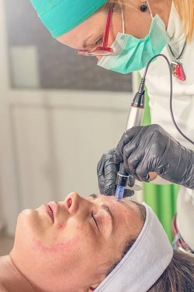 Şevval Özçelik Güzellik bir iğne Mezoterapi tedavisi bir kadının yüzünde gerçekleştirir.