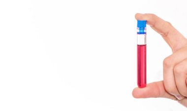 Kan testi, hızla yayılan Coronavirüs, Mers-Cov testi.