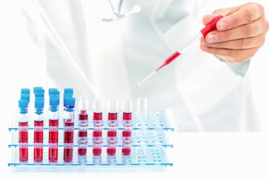 Tıbbi teçhizat, kan testi, hızla yayılan Coronavirüs, ben.