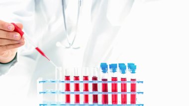 Tıbbi teçhizat, kan testi, hızla yayılan Coronavirüs, ben.