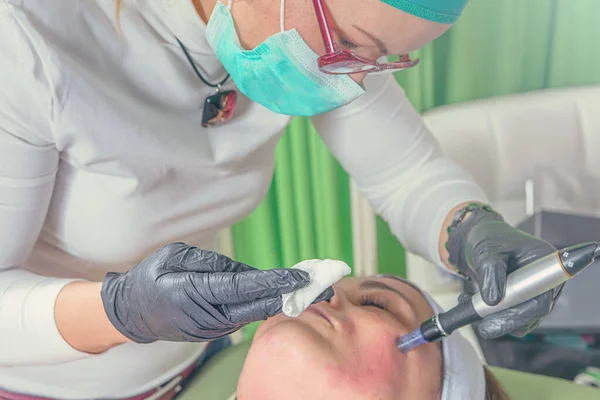 Schoonheidsspecialiste voert een naald Mesotherapie behandeling op een vrouw-fa — Stockfoto