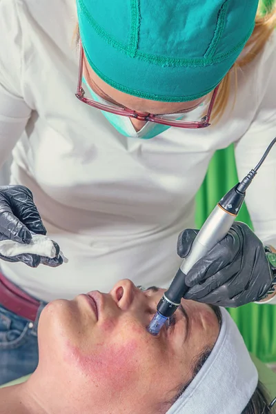 Schoonheidsspecialiste voert een naald Mesotherapie behandeling op een vrouw-fa — Stockfoto