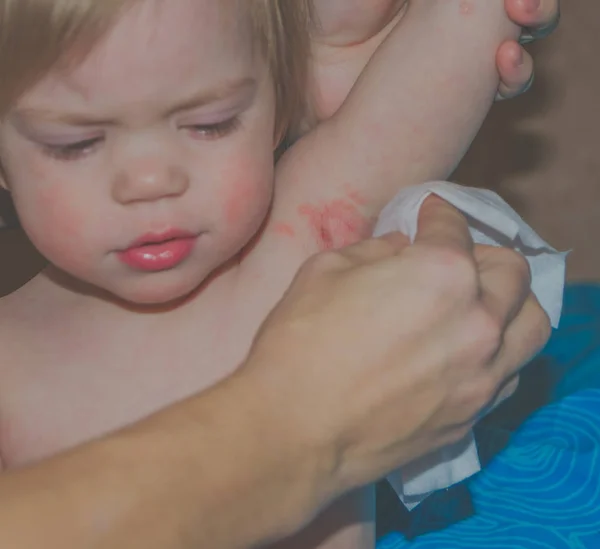El niño en la inflamación de la axila, mamá paño de limpieza — Foto de Stock