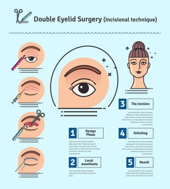 Vector Illustrated set with double eyelid surgery clipart