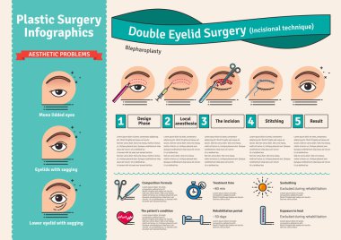 Vector Illustrated set with double eyelid surgery clipart