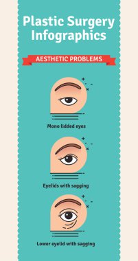 Göz kapağı cerrahisi için estetik sorunları olan vektör Illustrated ayarla