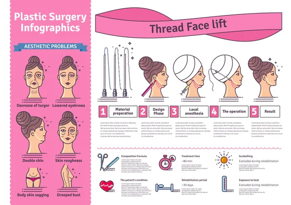 Vector Illustrated sertie de visage lifting chirurgie par threads — Image vectorielle