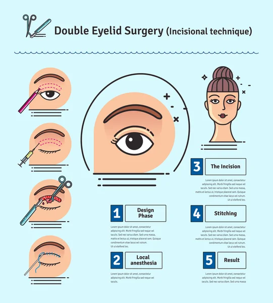 Ensemble vectoriel illustré avec double chirurgie de la paupière — Image vectorielle