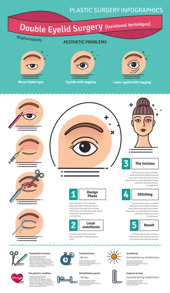 Ensemble vectoriel illustré avec double chirurgie de la paupière — Image vectorielle