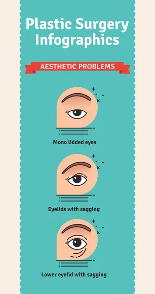 设置与眼睑手术的美学问题的矢量图解 — 图库矢量图片