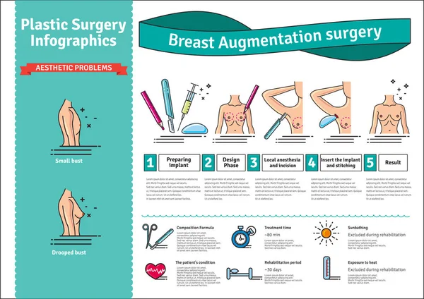Vektor illusztrált mellnagyobbító műtétek beállítása — Stock Vector