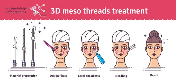 벡터 일러스트 3d Meso 스레드 얼굴 리프트 치료 설정 — 스톡 벡터