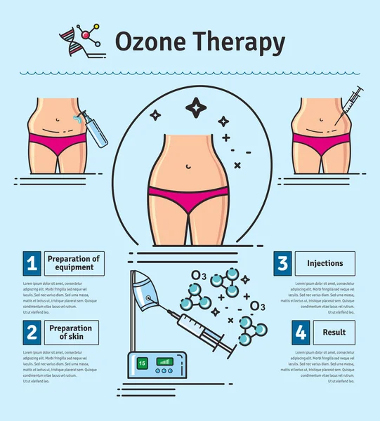 Set illustrato vettoriale con terapia cosmetologica all'ozono — Vettoriale Stock