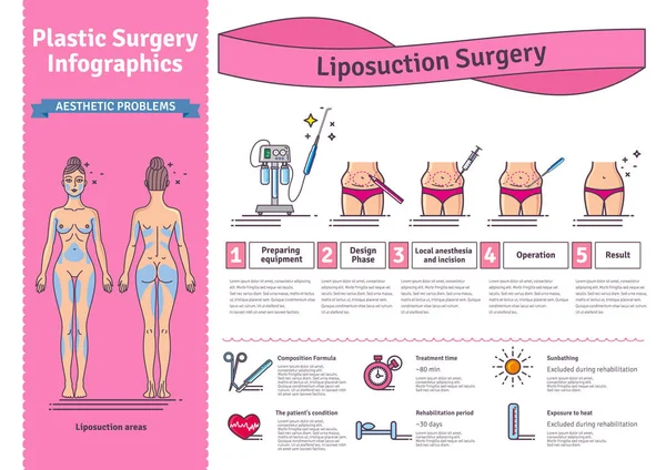 Vettore Set illustrato con chirurgia della liposuzione — Vettoriale Stock