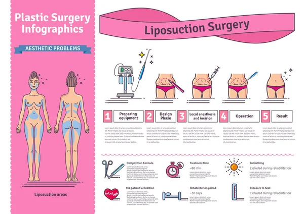 Ensemble vectoriel illustré avec chirurgie par liposuccion — Image vectorielle