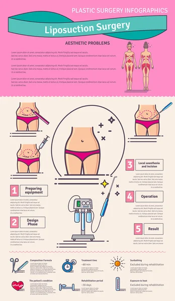 Ensemble vectoriel illustré avec chirurgie par liposuccion — Image vectorielle