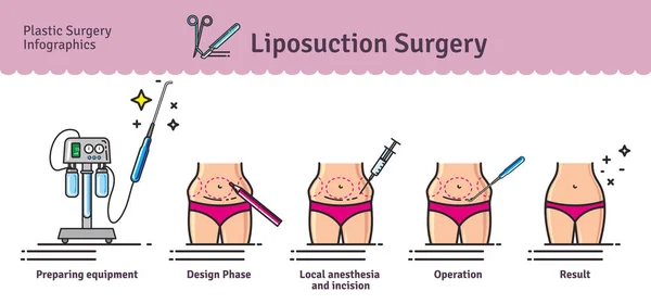 Ensemble vectoriel illustré avec chirurgie par liposuccion — Image vectorielle