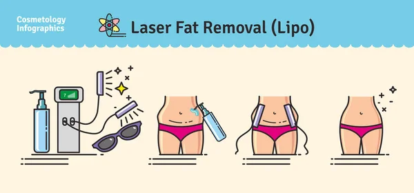 Conjunto ilustrado vetorial com remoção de gordura a laser LIPO —  Vetores de Stock