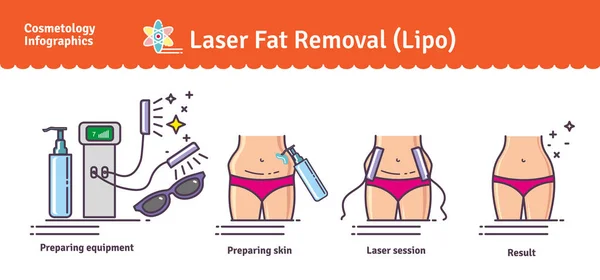 Векторный набор с лазером LIPO Fat Removal — стоковый вектор