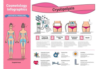 Vektör Illustrated kozmetik Cryolipolysis tedavi ile ayarla