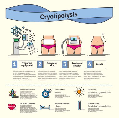Vektör Illustrated kozmetik Cryolipolysis tedavi ile ayarla