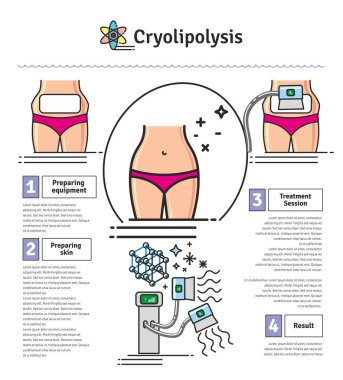 Vektör Illustrated kozmetik Cryolipolysis tedavi ile ayarla