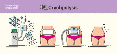 Vektör Illustrated kozmetik Cryolipolysis tedavi ile ayarla