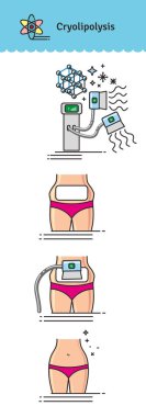 Vektör Illustrated kozmetik Cryolipolysis tedavi ile ayarla