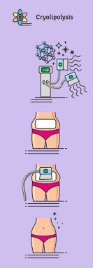 Vektör Illustrated kozmetik Cryolipolysis tedavi ile ayarla