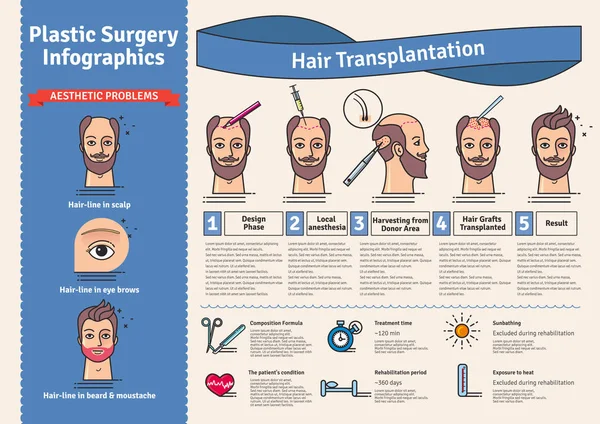 Conjunto ilustrado com cirurgia de transplante de cabelo —  Vetores de Stock