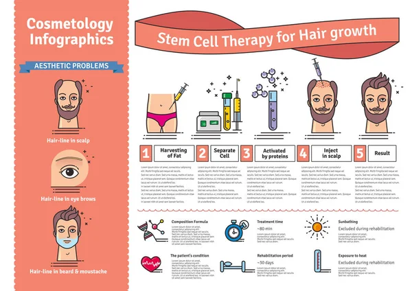 Ensemble vectoriel illustré avec thérapie par cellules souches pour la croissance des cheveux — Image vectorielle