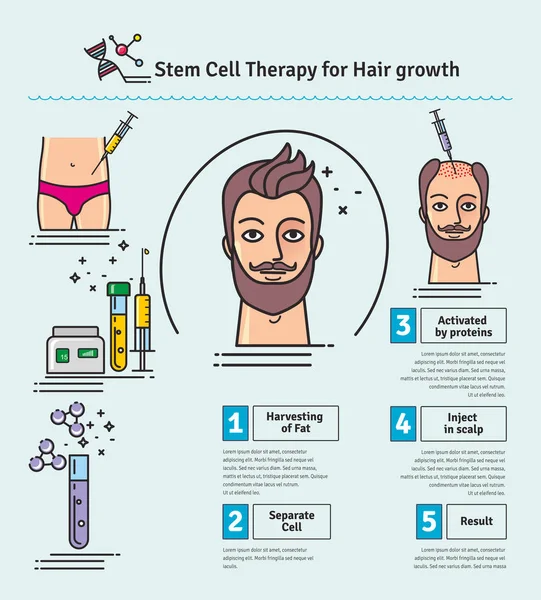 Ensemble vectoriel illustré avec thérapie par cellules souches pour la croissance des cheveux — Image vectorielle