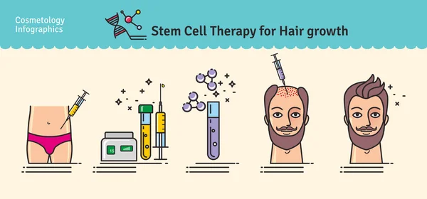 Vector Conjunto ilustrado con terapia de células madre para el crecimiento del cabello — Vector de stock