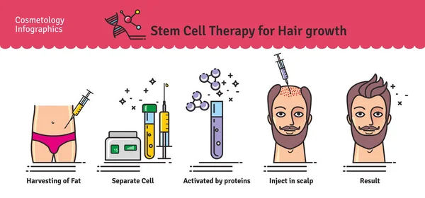 Vector Conjunto ilustrado con terapia de células madre para el crecimiento del cabello — Archivo Imágenes Vectoriales